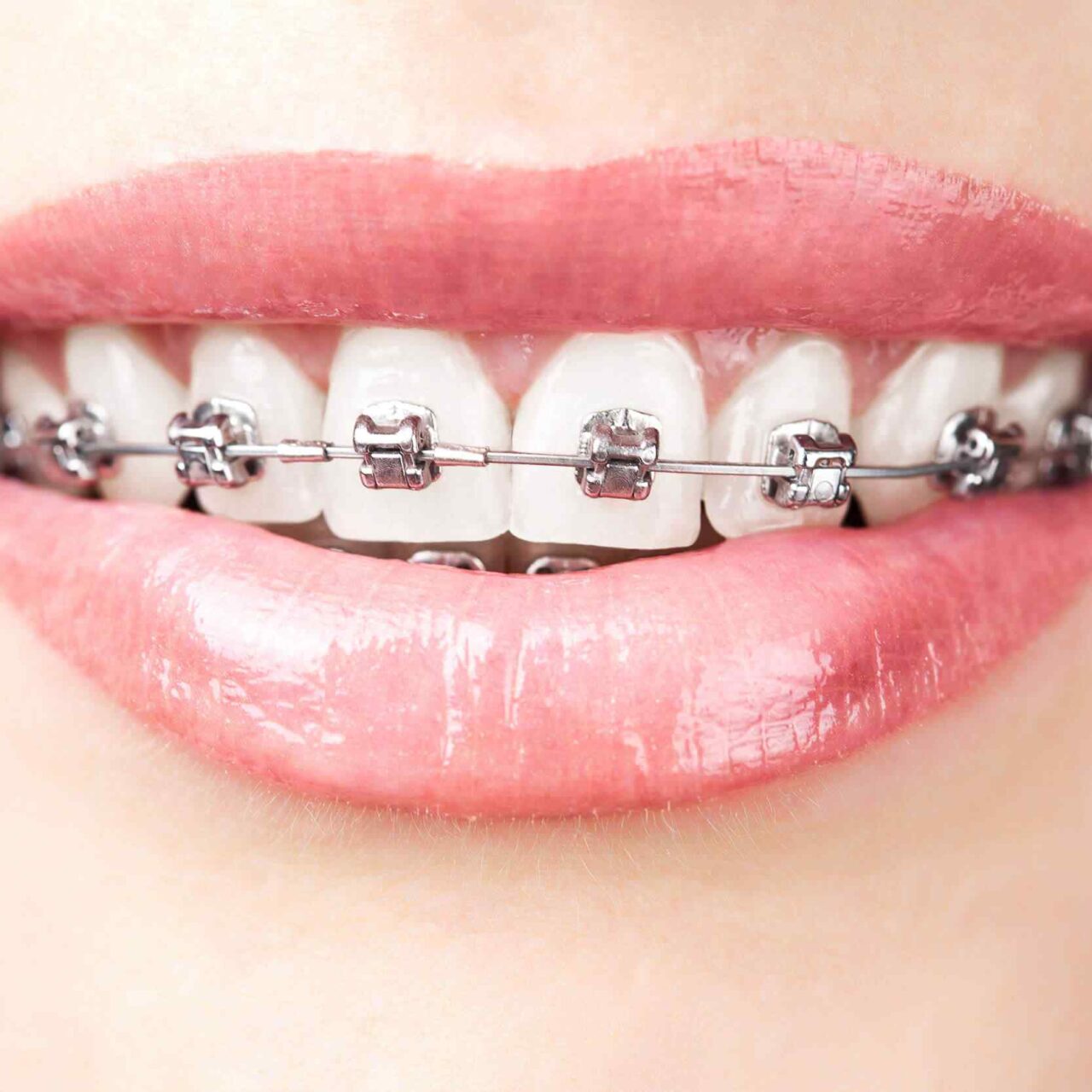 https://godental.travel/wp-content/uploads/2020/01/post-03-1-1280x1280.jpg