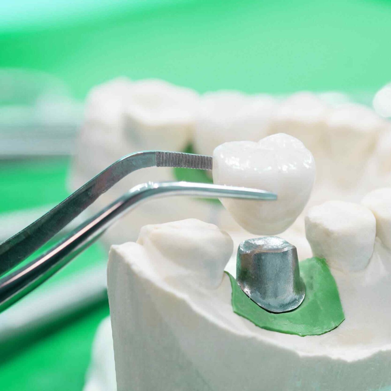 https://godental.travel/wp-content/uploads/2020/01/post-28-1-1280x1280.jpg