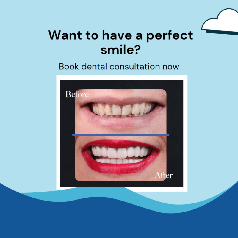 https://godental.travel/wp-content/uploads/2023/01/Go-Dental-Before-and-After-e1673717073356.png